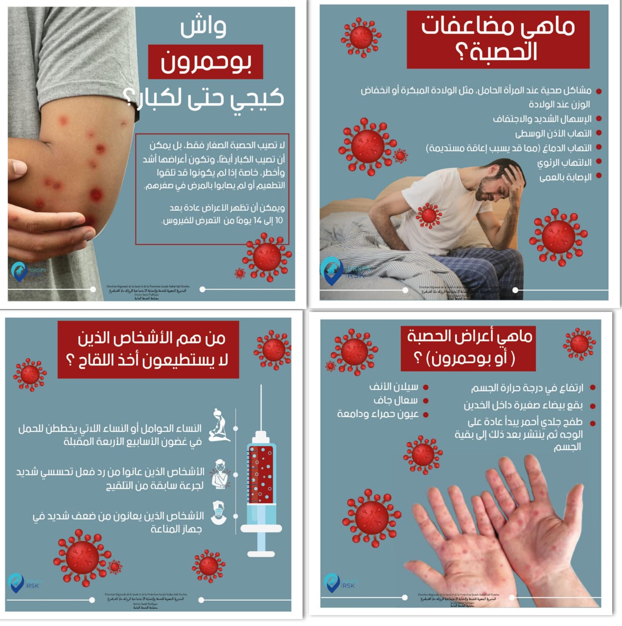 العيون.. انطلاق الحملة الوطنية لمراجعة واستدراك تلقيح الأطفال ضد “الحصبة”