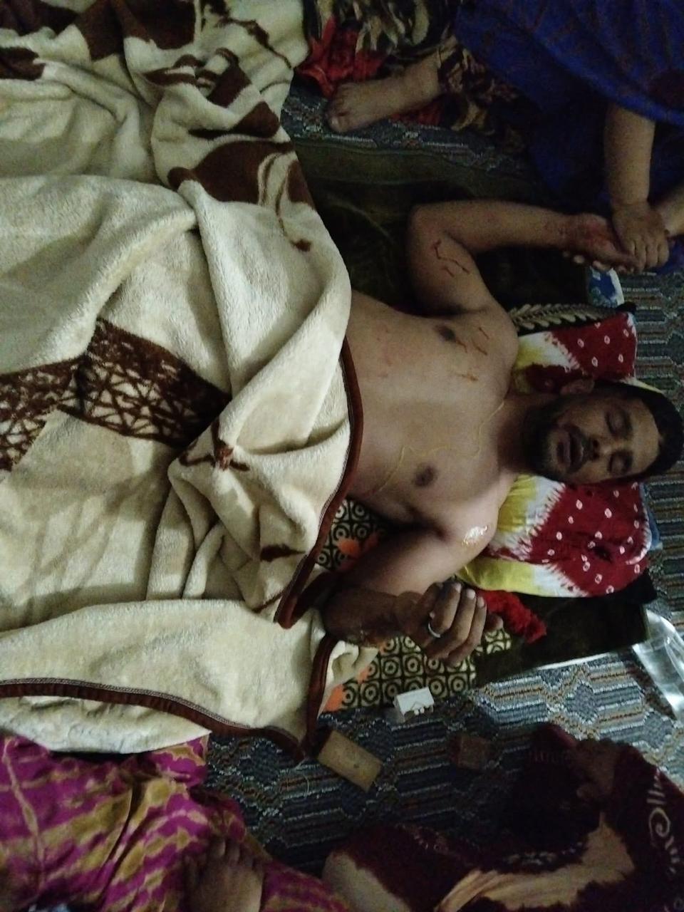 ميليشيا البوليساريو ترهب عائلة صحراوية وتعتدي بعنف على أحد أبنائها